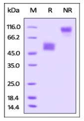 Rat TIGIT, Fc Tag on SDS-PAGE under reducing (R) and non-reducing (NR) conditions. The gel was stained overnight with Coomassie Blue. The purity of the protein is greater than 95%.
